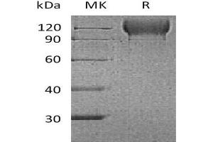 Western Blotting (WB) image for Selectin P (Granule Membrane Protein 140kDa, Antigen CD62) (SELP) protein (His tag,AVI tag) (ABIN7320863) (P-Selectin Protein (His tag,AVI tag))