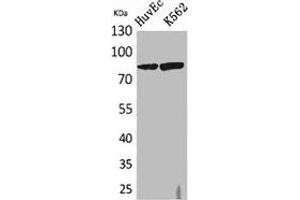 Western Blot analysis of HuvEc, K562 cells using 17β-HSD4 Polyclonal Antibody. (HSD17B4 抗体  (N-Term))