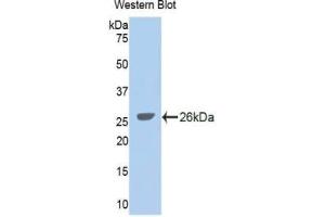 WB of Protein Standard: different control antibodies against Highly purified E. (GLDC ELISA 试剂盒)