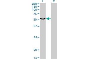 Western Blotting (WB) image for anti-Target of EGR1, Member 1 (Nuclear) (TOE1) (AA 1-511) antibody (ABIN599318) (TOE1 抗体  (AA 1-511))