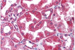 Immunohistochemistry (Formalin-fixed Paraffin-embedded Sections) (IHC (fp)) image for anti-Signal Transducer and Activator of Transcription 3 (Acute-Phase Response Factor) (STAT3) (N-Term) antibody (ABIN6745716)