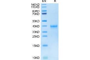 Human IGSF11 on Tris-Bis PAGE under reduced condition. (IGSF11 Protein (AA 23-241) (His tag))