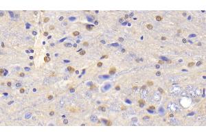 Detection of GS in Rat Cerebrum Tissue using Polyclonal Antibody to Glutamine synthetase (GS) (GLN1 抗体  (AA 1-373))