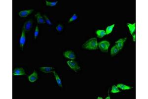 Immunofluorescence (IF) image for anti-SMAD Specific E3 Ubiquitin Protein Ligase 1 (SMURF1) (AA 198-374) antibody (ABIN7151222)