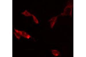 Immunofluorescence (fixed cells) (IF/ICC) image for anti-Sodium Channel, Nonvoltage-Gated 1, delta (SCNN1D) (C-Term) antibody (ABIN6257772)