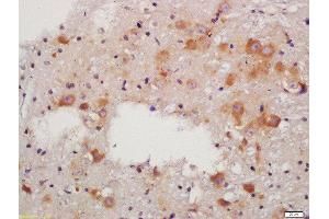 Formalin-fixed and paraffin embedded rat brain labeled with Anti-RALDH2 Polyclonal Antibody, Unconjugated  at 1:200 followed by conjugation to the secondary antibody and DAB staining