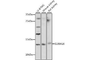 Western blot analysis of extracts of various cell lines, using S100 antibody (167) at 1:1000 dilution.