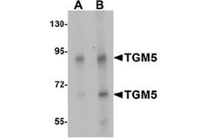 Western blot analysis of TGM5 in rat heart tissue lysate with TGM5 Antibody  at (A) 1 and (B) 2 ug/mL. (Transglutaminase 5 抗体  (C-Term))
