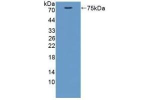 Detection of Recombinant CTTN, Mouse using Polyclonal Antibody to Cortactin (CTTN) (Cortactin 抗体  (AA 1-509))