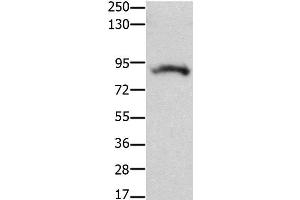 Western Blot analysis of Mouse brain tissue using KCNH2 Polyclonal Antibody at dilution of 1:100 (KCNH2 抗体)
