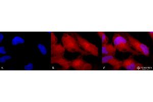 Immunocytochemistry/Immunofluorescence analysis using Rabbit Anti-Erk1/2 Polyclonal Antibody . (ERK1 抗体  (FITC))