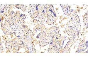 Detection of CGb in Human Placenta Tissue using Monoclonal Antibody to Chorionic Gonadotropin Beta Polypeptide (CGb) (CGB 抗体  (AA 31-165))