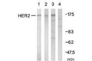 Western blot analysis of extracts from A2780 cells, using HER2 (Ab-1248) Antibody. (ErbB2/Her2 抗体  (AA 1206-1255))