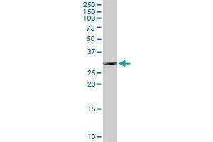 CBR1 MaxPab rabbit polyclonal antibody. (CBR1 抗体  (AA 1-277))
