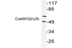 Western blot (WB) analysis of CaMKIIbeta/gamma/delta antibody in extracts from rat brain cells. (CAMK2B 抗体)