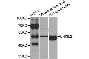Western blot analysis of extracts of various cells, using CHI3L2 antibody. (CHI3L2 抗体)