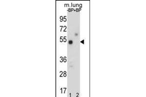 Western Blotting (WB) image for anti-TOX High Mobility Group Box Family Member 3 (TOX3) (AA 214-242) antibody (ABIN651009)