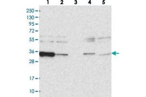 Western blot analysis of Lane 1: RT-4, Lane 2: U-251 MG, Lane 3: Human Plasma, Lane 4: Liver, Lane 5: Tonsil with ACTR6 polyclonal antibody .