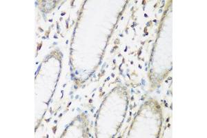 Immunohistochemistry of paraffin-embedded human stomach using EIF2B2 antibody (ABIN5975464) at dilution of 1/200 (40x lens). (EIF2B2 抗体)