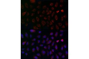 Immunofluorescence analysis of A-549 cells using MCU Rabbit pAb (ABIN7268549) at dilution of 1:200 (40x lens). (MCU 抗体  (AA 1-351))