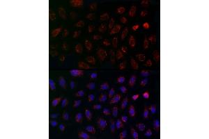 Immunofluorescence analysis of A-549 cells using MCU Rabbit pAb (ABIN7268549) at dilution of 1:200 (40x lens). (MCU 抗体  (AA 1-351))