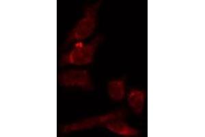 ABIN6274038 staining HepG2 by IF/ICC. (Melanoma gp100 抗体  (C-Term))