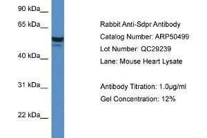 Western Blotting (WB) image for anti-Serum Deprivation Response (SDPR) (N-Term) antibody (ABIN2773968)
