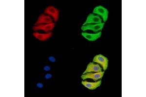 ABIN7096403 and ABIN7100467 staining Hela cells by IF/ICC. (TIMMDC1 抗体)
