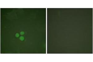 Immunofluorescence analysis of HeLa cells, using DP-1 Antibody. (TGM4 抗体  (AA 361-410))