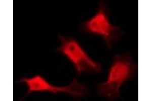 ABIN6274935 staining HeLa by IF/ICC. (CHP 抗体  (Internal Region))