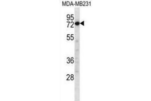 Western Blotting (WB) image for anti-Calpain 8 (CAPN8) antibody (ABIN2997182) (Calpain 8 抗体)