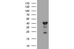 Image no. 1 for anti-Transmembrane Protein 173 (TMEM173) antibody (ABIN1501430) (STING/TMEM173 抗体)