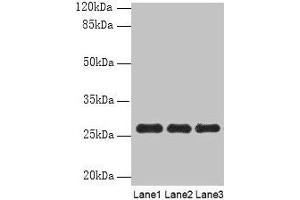 Western blot All lanes: PEX11B antibody at 10 μg/mL Lane 1: 293T whole cell lysate Lane 2: Hela whole cell lysate Lane 3: K562 whole cell lysate Secondary Goat polyclonal to rabbit IgG at 1/10000 dilution Predicted band size: 29, 27 kDa Observed band size: 27 kDa (PEX11B 抗体  (AA 9-228))