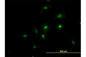 Image no. 2 for anti-RNA Binding Motif Protein 39 (RBM39) (AA 423-473) antibody (ABIN599086) (RBM39 抗体  (AA 423-473))