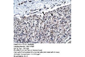 Rabbit Anti-HCLS1 Antibody  Paraffin Embedded Tissue: Human Heart Cellular Data: Myocardial cells Antibody Concentration: 4. (HCLS1 抗体  (N-Term))