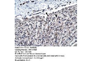 Rabbit Anti-HCLS1 Antibody  Paraffin Embedded Tissue: Human Heart Cellular Data: Myocardial cells Antibody Concentration: 4.