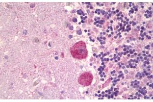 Anti-MAPK15 antibody IHC staining of human brain, cerebellum. (MAPK15 抗体  (AA 1-245))