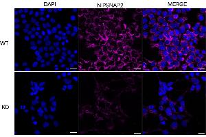 Immunocytochemical staining of HeLa cells using NIPSNAP2 antibody (ABIN7798724), 1:1,000), Top panel: wild-type (WT), Bottom panal: NIPSNAP2 shRNA knockdown (KD). (GBAS 抗体)