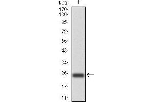 Western Blotting (WB) image for anti-NADPH Oxidase 4 (NOX4) (AA 210-310) antibody (ABIN5872374) (NADPH Oxidase 4 抗体  (AA 210-310))
