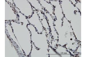 Immunoperoxidase of monoclonal antibody to VDR on formalin-fixed paraffin-embedded human lung. (Vitamin D Receptor 抗体  (AA 1-427))