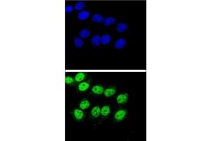 Confocal immunofluorescent analysis of BAG1 Antibody (C-term) (ABIN389451 and ABIN2839520) with Hela cell followed by Alexa Fluor® 488-conjugated goat anti-rabbit lgG (green). (BAG1 抗体  (C-Term))