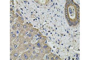 Immunohistochemistry of paraffin-embedded Human liver damage using KCNK9 Polyclonal Antibody at dilution of 1:100 (40x lens). (KCNK9 抗体)