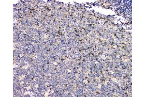 IHC analysis of SHP2/PTPN11 using anti SHP2/PTPN11 antibody (ABIN6719583).