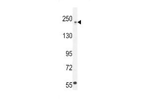 Western Blotting (WB) image for anti-Collagen, Type V, alpha 1 (COL5A1) (AA 54-82), (N-Term) antibody (ABIN5530939)