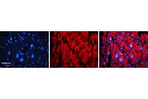 Immunohistochemistry (IHC) image for anti-ATPase, Ca++ Transporting, Type 2C, Member 1 (ATP2C1) (C-Term) antibody (ABIN2781847)