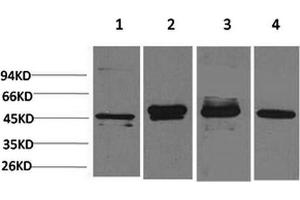 Western Blotting (WB) image for anti-Growth Associated Protein 43 (GAP43) antibody (ABIN5955883) (GAP43 抗体)