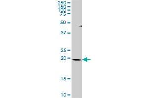 THAP1 MaxPab rabbit polyclonal antibody. (THAP1 抗体  (AA 1-213))