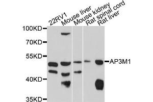 Western blot analysis of extracts of various cell lines, using AP3M1 antibody (ABIN4902920) at 1:1000 dilution.