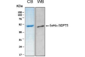 10% SDS-PAGE stained with Coomassie Blue (CB), immunobloting with anti-6xHis (WB) serum and peptide fingerprinting by MALDI-TOF-TOF mass spectrometry (Septin 5 Protein (SEPT5) (AA 1-369) (His tag))