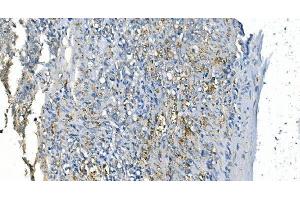 IHC analysis of Carbonic Anhydrase I/CA1 using anti-Carbonic Anhydrase I/CA1 antibody (ABIN7602620). (CA1 抗体  (AA 9-261))